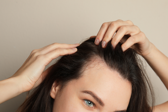 Everything You Need to Know About Female Hair Loss
